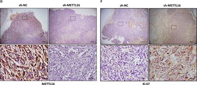 Corrigendum: The m6A methyltransferase METTL16 inhibits the proliferation of pancreatic adenocarcinoma cancer cells via the p21 signaling pathway